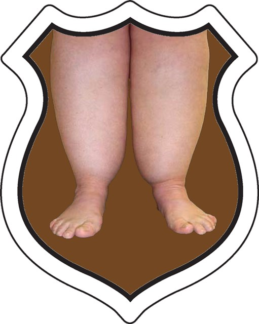 badge_bigfeet.png badge_bigfeet.png